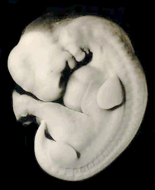 stereo pair - embryo prior to sectioning